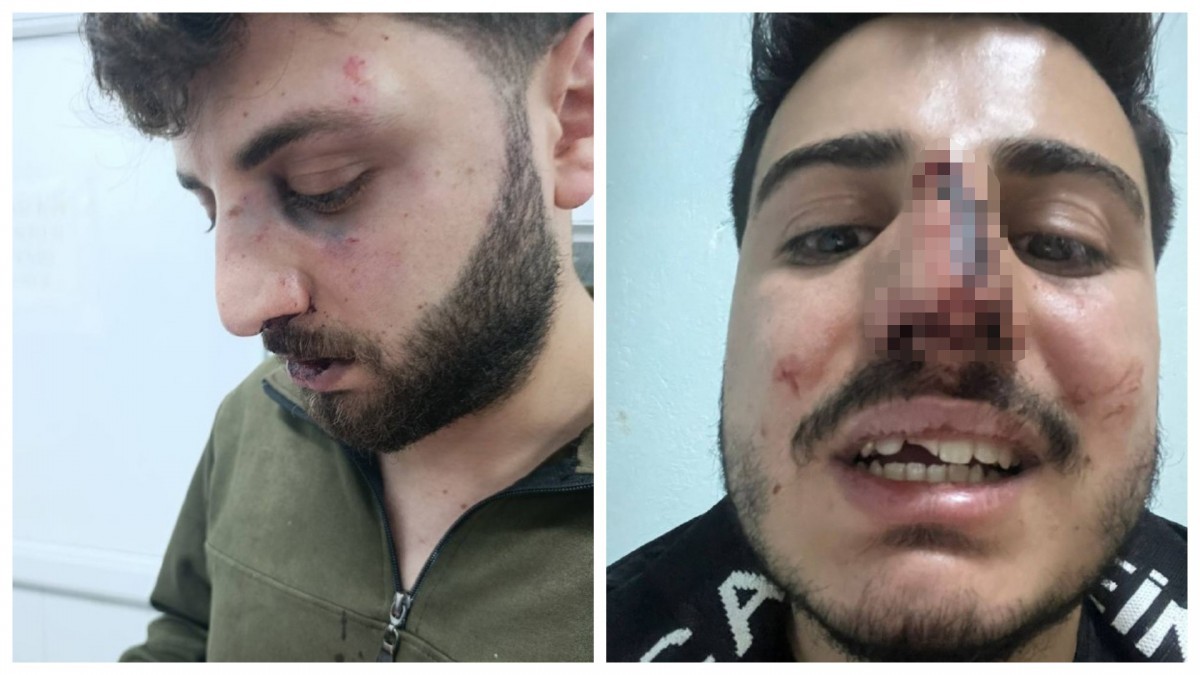 Van’da Üç Kardeşe Polis İşkencesi: 13 Memur Hakkında Soruşturma Başlatıldı