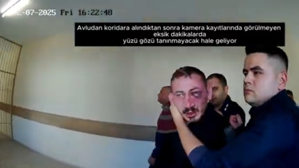 Akhisar Cezaevi’nde işkence belgelendi: Gardiyanlardan tutukluya ağır darp