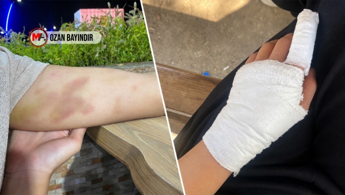 Batman’da Komşu Polisinden Şiddet: Işık Ailesi Ayrımcı Saldırının Hedefi Oldu